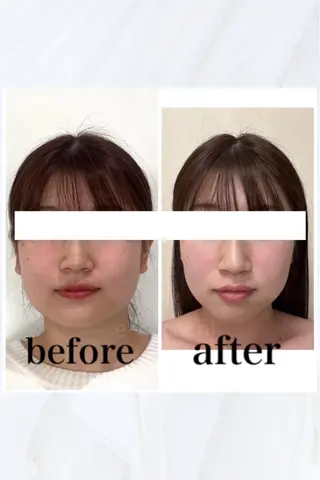 小顔と ヘッドスパのお店のエステ・リラクイメージ