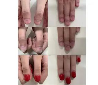 ネイル 毛穴改善/脱毛 ネイル 川上久仁子のエステ・リラクイメージ