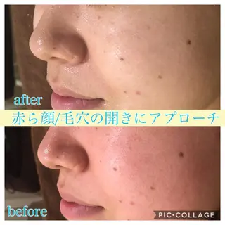 ショート カラー パーマ ヘアアレンジ キッズ ネイル マツエク・マツパ Ensor Clair所属・EnsorClair 代表 野口真央のエステ・リラクイメージ