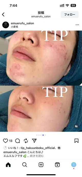 shaving room 晴のエステ・リラクイメージ