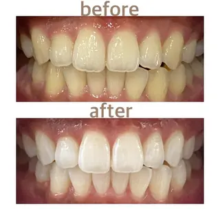 メンズ ホワイトニング ショップ本八幡店のエステ・リラクイメージ