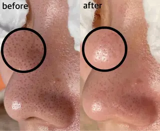 韓国肌管理 【毛穴専科】のエステ・リラクイメージ