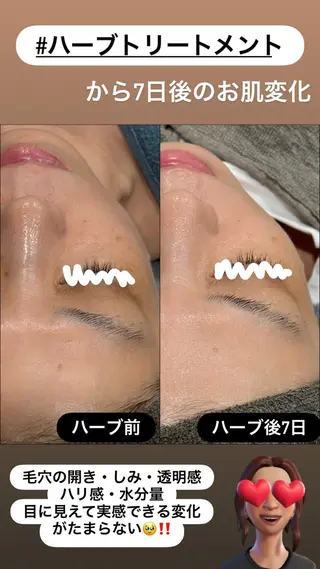 LiZA エステティックサロンのエステ・リラクイメージ