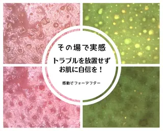 毛穴専門店Bébé 大阪中央店のエステ・リラクイメージ