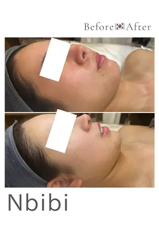 韓国🇰🇷価格 サロン_Nbibiのエステ・リラクイメージ