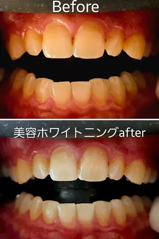 歯科提携セルフダック 宇都宮駒生店のエステ・リラクイメージ