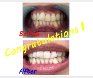 セルフホワイトニングサロン　ラヴィアン所属・ホワイトニングサロン La vie enのその他イメージ