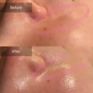 Mandarin Orange所属・毛穴から始める肌メン テマンダリンオレンジのエステ・リラクイメージ