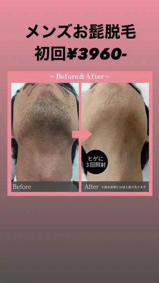 脱毛＆エステ　GLG 徳並のエステ・リラクイメージ