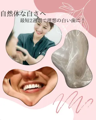 ホワイトニングショップ静岡葵区店所属・ホワイトニング ショップ静岡葵区店のその他イメージ