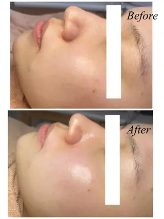 ネイル Private salon Dux所属・肌管理&nail Salon  Duxの眉毛・アイブロウイメージ