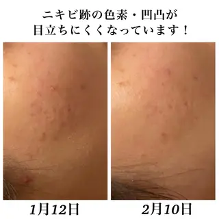 Bellesthe (ベルエステ)のエステ・リラクイメージ