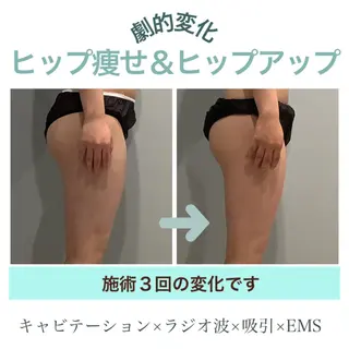 エステサロン JURISのエステ・リラクイメージ