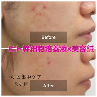 gomi sayakaのエステ・リラクイメージ