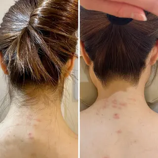 うなじ脱毛/美肌脱毛 LABELのエステ・リラクイメージ