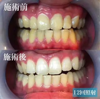 LBSホワイトニング上野店所属・LBSホワイトニング 🌐 上野店公式のエステ・リラクイメージ