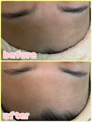 メンズ キッズ 肌質改善・脱毛サロン Luangeのエステ・リラクイメージ