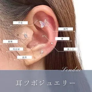 美楽鍼 びらくしんのその他イメージ