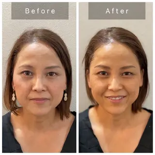 salon Lewis Addict所属・ルイスアディクト 名駅店のエステ・リラクイメージ