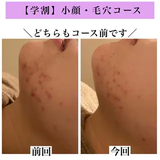 Bellesthe (ベルエステ)のエステ・リラクイメージ