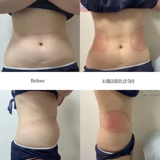 冷却専門店 SLARIのエステ・リラクイメージ