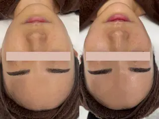 べアール所属・小顔/毛穴/白玉肌 salon bealのその他イメージ