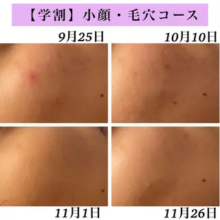 Bellesthe (ベルエステ)のエステ・リラクイメージ