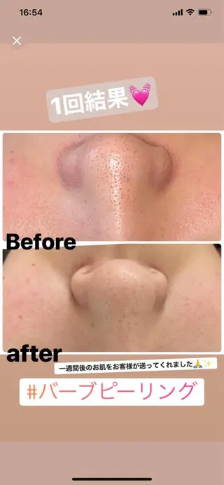 FLEUR大阪・美容 整体・痩身・小顔のエステ・リラクイメージ