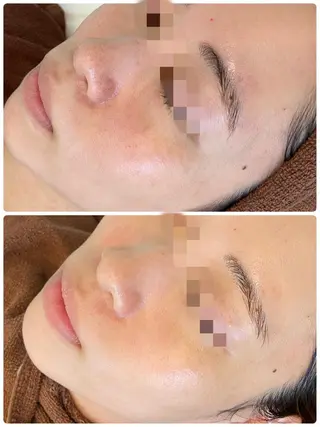 ハーブピーリング専門 BIOPLUS+川崎のエステ・リラクイメージ