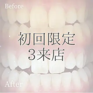 メンズ ホワイトニング ショップ多摩店のその他イメージ