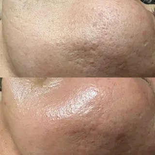 lymph care 'Welnəsのエステ・リラクイメージ