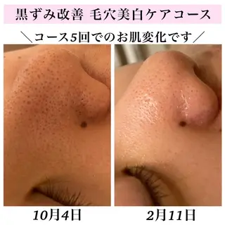 Bellesthe (ベルエステ)のエステ・リラクイメージ