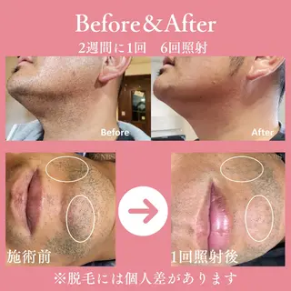 メンズ 有人型セルフサロン 脱毛/痩身/美顔のその他イメージ