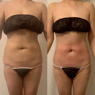 痩身専門店 GRANDIRのエステ・リラクイメージ