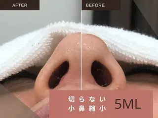 痩身・リラク KOZUEのエステ・リラクイメージ