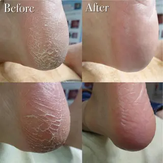 サンキューフット浦和店所属・サンキューフット 浦和店のエステ・リラクイメージ