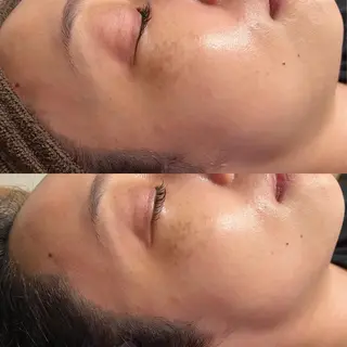 Epina 千葉店 【エピナ】のエステ・リラクイメージ