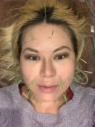 メンズ 美容鍼灸サロン LOMIHARIのエステ・リラクイメージ