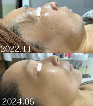 NiU.BEAUTY🥥池袋店所属・ハーブピーリング専門 NiU.BEAUTYのエステ・リラクイメージ