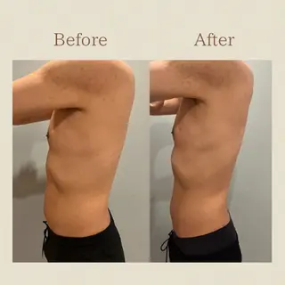 お腹痩せエステ Flat BELLY 恵比寿所属・【腸もみ/脂肪冷却】 お腹エステ/恵比寿のエステ・リラクイメージ