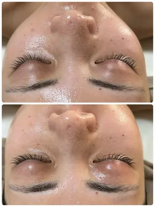 Beauty salon Wish所属・脱毛🌈肌質改善🌈 Wishのエステ・リラクイメージ