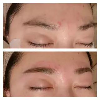 メンズ アイブロウ B&H所属・頭痛•肩こり専門/ 眉サロンB&H心斎橋のエステ・リラクイメージ