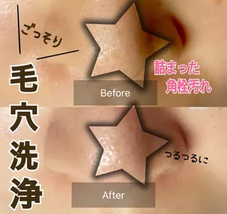 LOVELASH所属・目黒☆脱毛☆マツエク まつパ☆ララピールのマツエク・マツパデザイン