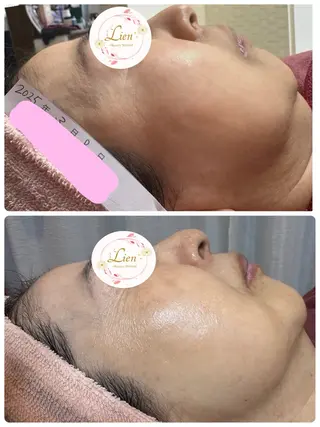 Lien オーナー 山口智嘉のエステ・リラクイメージ