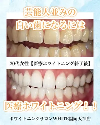 メンズ ホワイトニング専門店 WHITE天神店のエステ・リラクイメージ