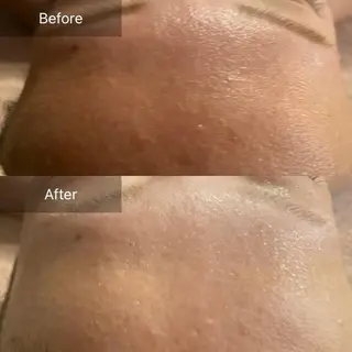 Mandarin Orange所属・毛穴から始める肌メン テマンダリンオレンジのエステ・リラクイメージ