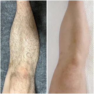 宮代・脱毛サロンMIIN所属・脱毛/ホワイトニング 美白ケア🫧MIINのエステ・リラクイメージ