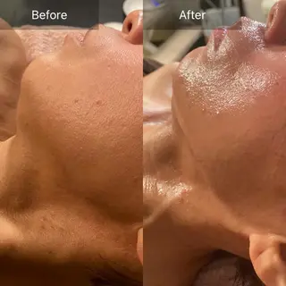 Mandarin Orange所属・毛穴から始める肌メン テマンダリンオレンジのエステ・リラクイメージ