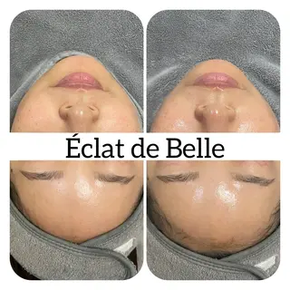 Éclat de Belle🫧白玉肌のエステ・リラクイメージ