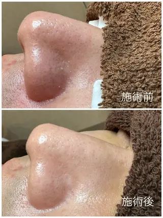 メンズ 岩本 麻那のマツエク・マツパデザイン